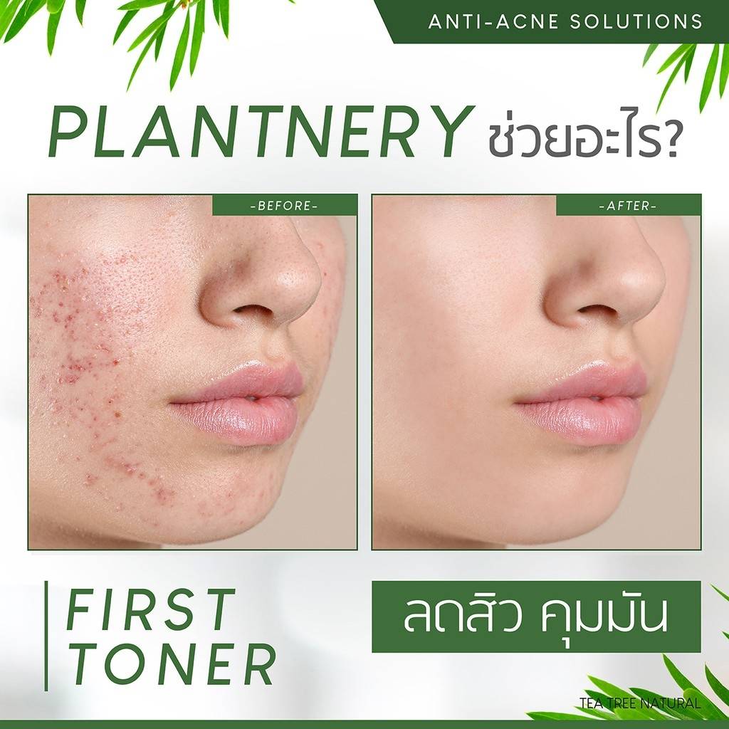 Plantnery Tea Tree First Toner 