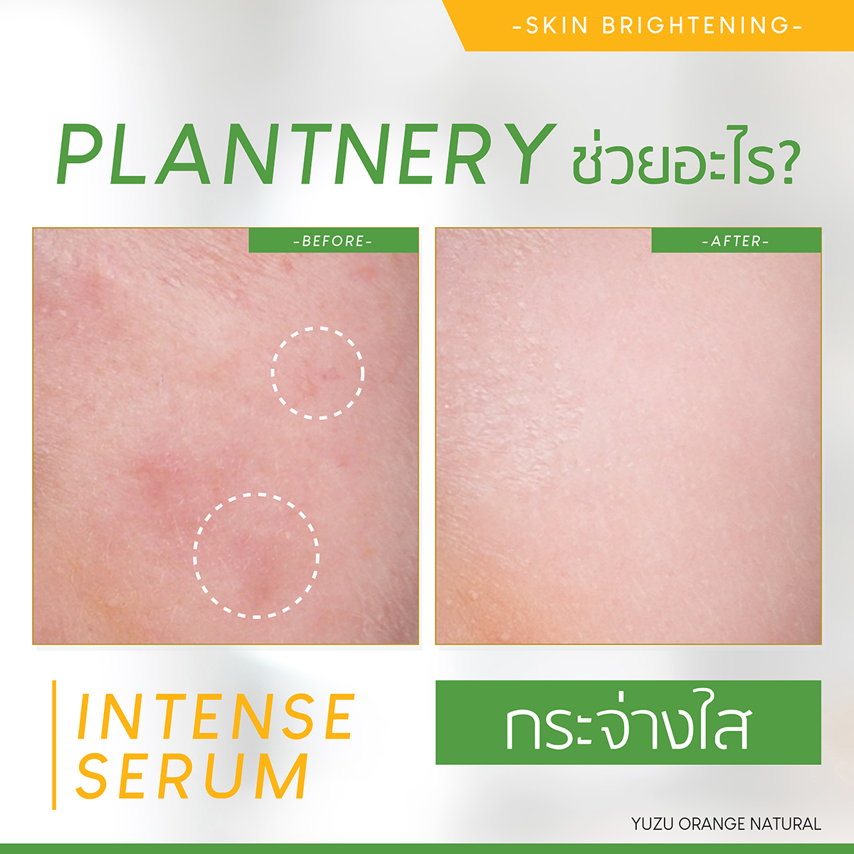 Plantnery Yuzu Orange intense Serum 30ml เซรั่ม Vit C เข้มข้นจากผลส้มยูซุ ประเทศญี่ปุ่น เพื่อผิวกระจ่างใส